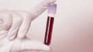 Una muestra de sangre podría sustituir a la biopsia para detectar el cáncer