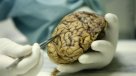 Desaparecieron 100 cerebros conservados en universidad estadounidense