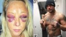Boxeador golpeó a su pareja hasta dejarla inconsciente y después se victimizó