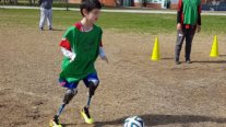 El notable gesto de Antoine Griezmann con un niño argentino que perdió sus dos piernas