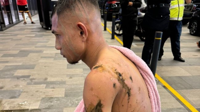   Futbolista sufrió quemaduras tras ser atacado con ácido 