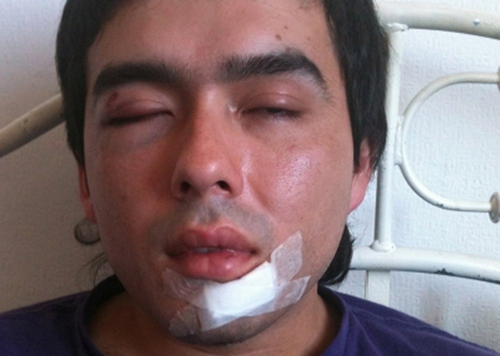 Denuncian ataque homofóbico contra joven valdiviano