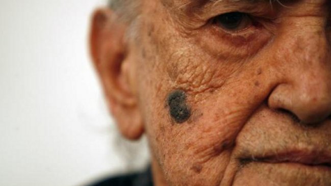 Arquitecto brasileño Oscar Niemeyer sufrió empeoramiento de su función renal