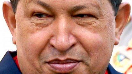 Diputado venezolano: Los médicos deben informarle al país cómo está el presidente