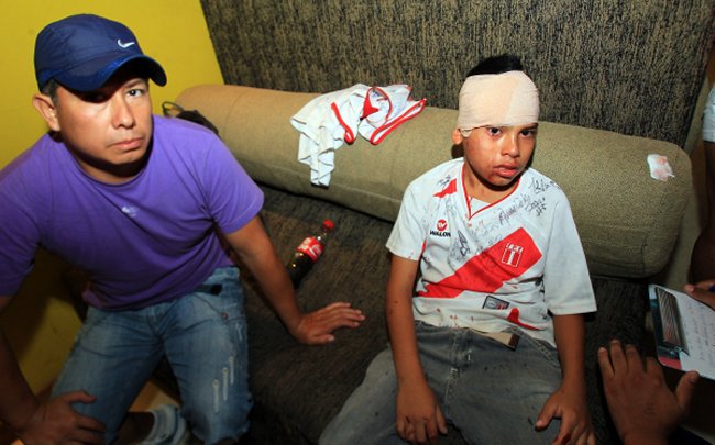 Prensa peruana denunció que hinchas chilenos agredieron a mujeres y niños