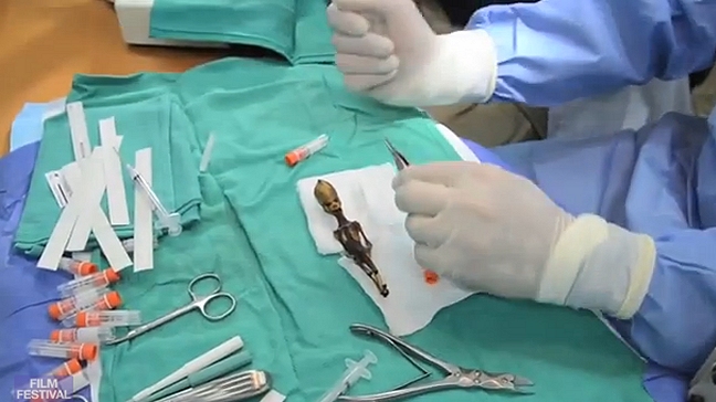 Supuesto alienígena en Atacama mostrado en documental es un feto humano, según experto