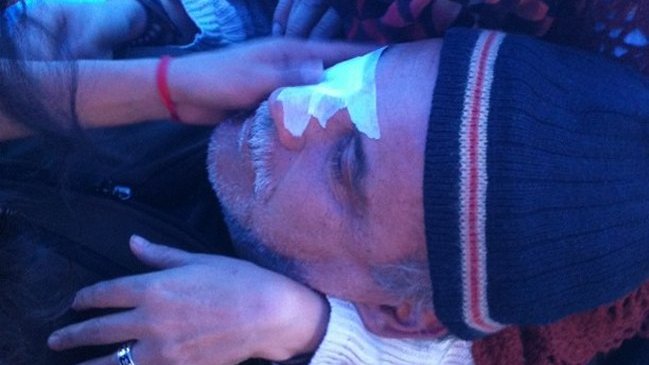 Herido por balín de pintura anunció querella contra Carabineros