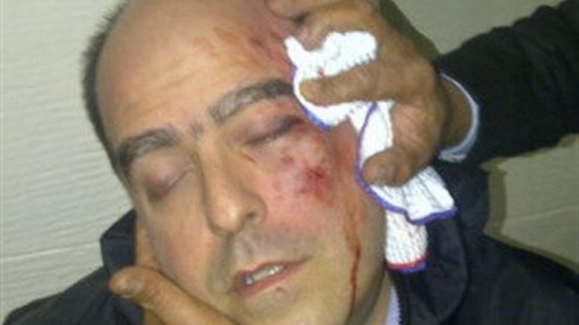 Diputados opositores fueron agredidos en el Parlamento venezolano