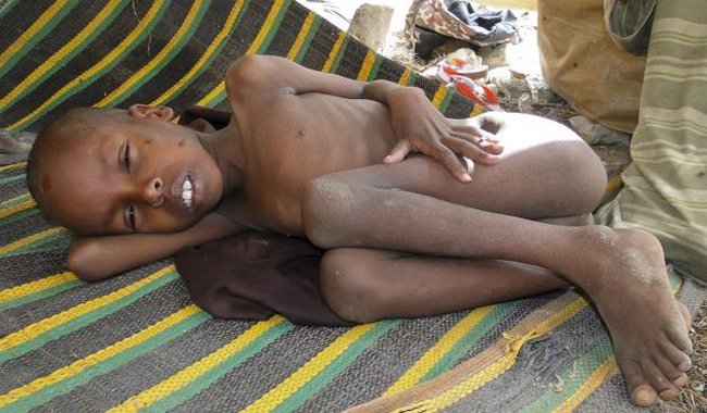 Somalia: Hambruna de 2011 causó 258 mil muertes