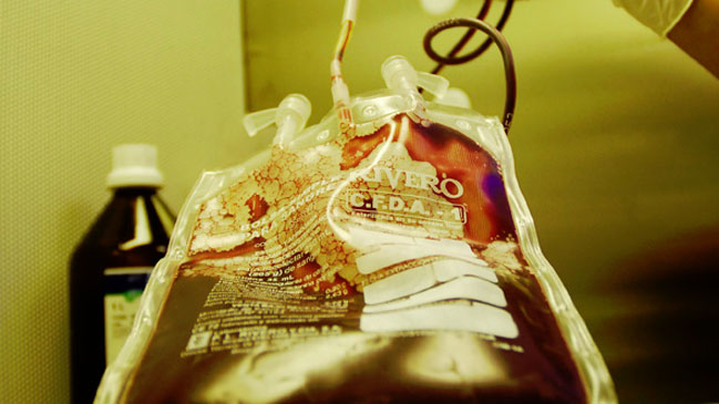 Banco chileno de células madres lanzó método de obtención de material biológico