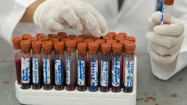 Científico defiende posible cura del sida con trasplante de médula ósea