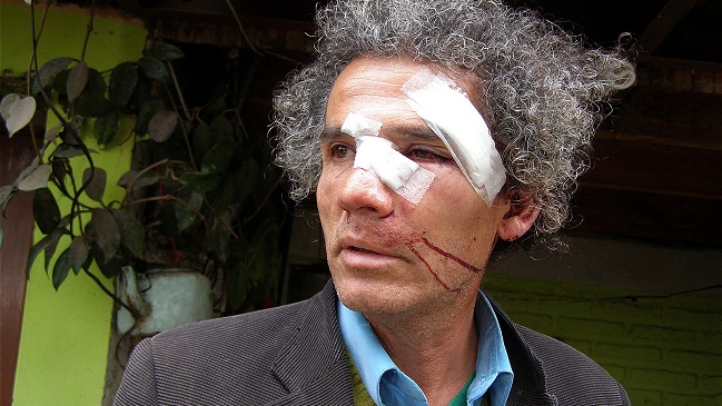 Ex preso político denunció agresión de Carabineros en conmemoración del 