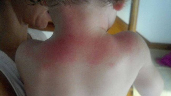 Bloqueador infantil retirado en Argentina ya no se vende en Chile