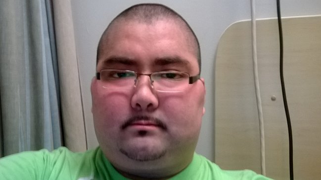 Joven que enfrentó a su isapre invita a sumarse a campaña a favor de la 