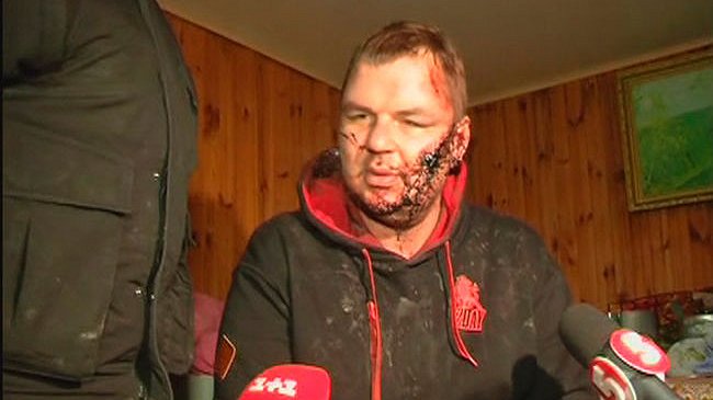 Opositor ucraniano denuncia haber sido secuestrado, torturado y crucificado