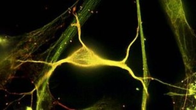 Imagen foto_00000003