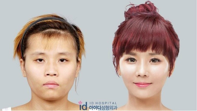 Reality show transformó rostro de joven surcoreana con cirugía estética