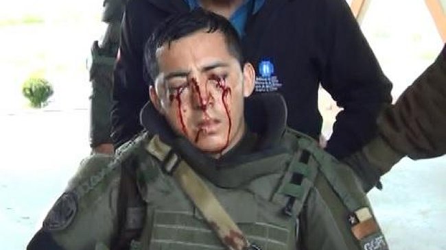 Carabinero herido en el rostro por perdigones se encuentra grave