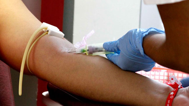 Descubren sistema para detectar el cáncer de pulmón con un análisis de sangre