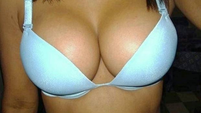 Francia estudia prohibir prótesis mamarias por cáncer vinculado