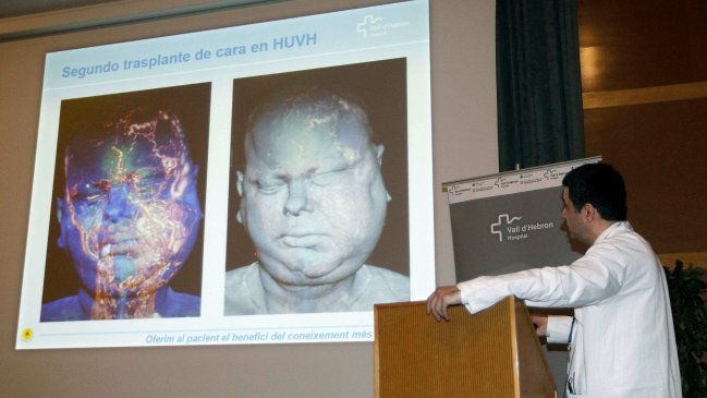 Reconstruyeron la cara a hombre con múltiples tumores
