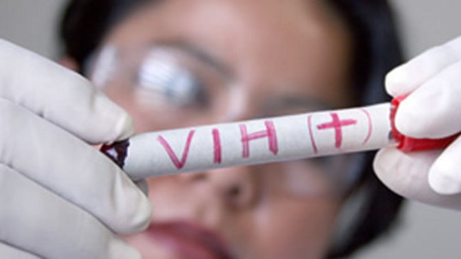 El tratamiento inmediato tras diagnóstico de VIH reduce riesgos en un 57 por ciento