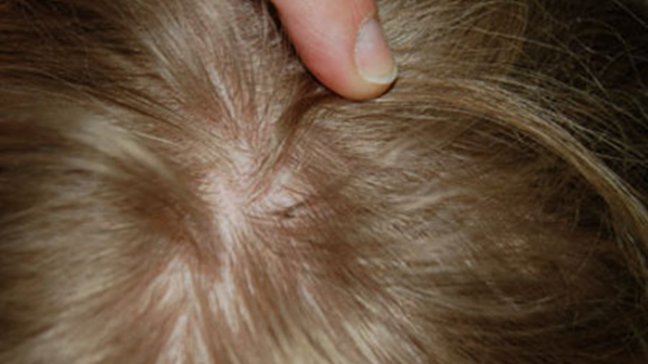 Al menos 25 estados de EE.UU. tienen 