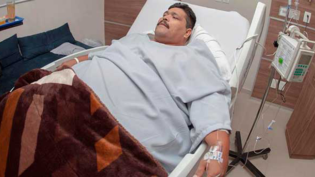 Hombre más obeso del mundo recibe el alta hospitalaria tras exitosa cirugía