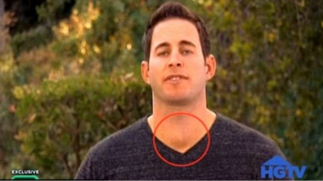 Conductor de TV se salvó de cáncer gracias a una televidente