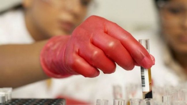 China registra un total de 575.000 personas afectadas por el VIH/SIDA