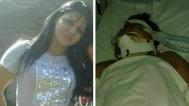 Conmoción en Argentina por joven violada, baleada y mutilada