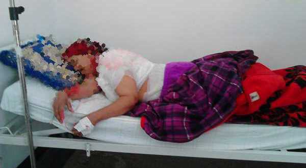 Marroquí quemó a su mujer con agua hirviendo porque no le permitió una segunda esposa