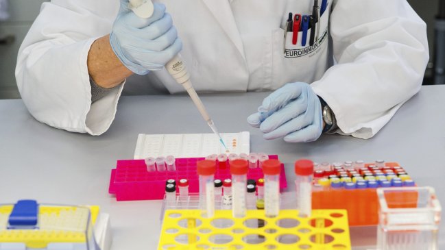 Brasil detecta el Zika en orina y saliva e investiga si pueden transmitirlo