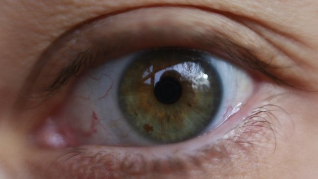 ¿Por qué a veces tirita el párpado?