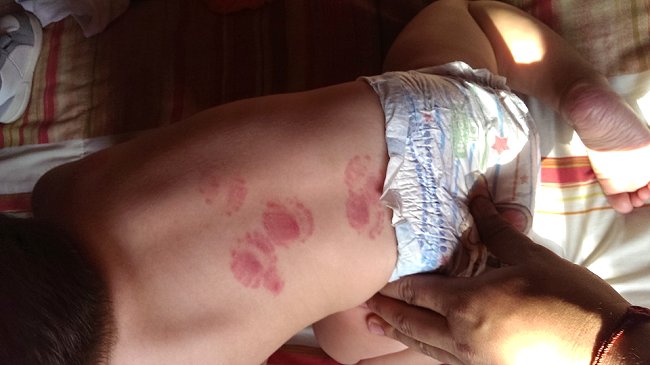 Padre denunció maltrato a su hijo de un año en guardería de Santiago