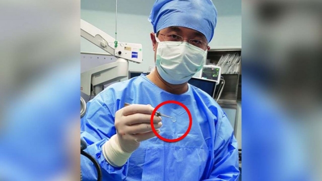 Un joven chino recuperó la vista tras un trasplante de una córnea de cerdo