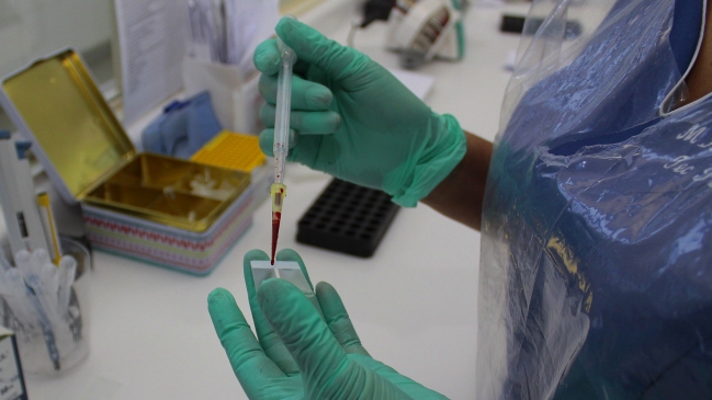 Confirman nuevo caso de virus hanta en la Región de La Araucanía