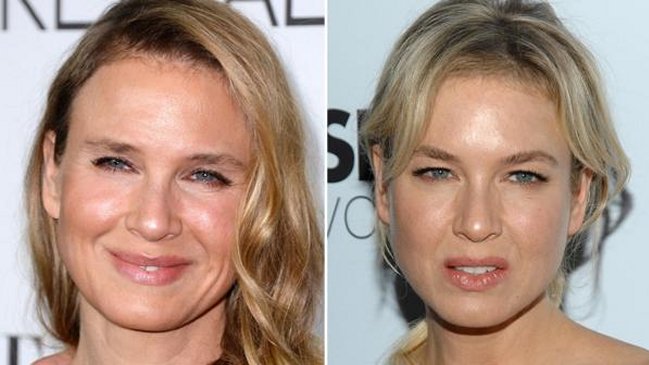 La contundente respuesta de Renee Zellweger a quienes la critican por sus cirugías