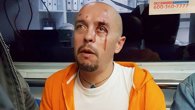 Valparaíso: Estudiante golpeó a no vidente y fue detenido en su liceo