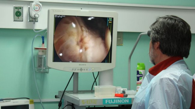 Médicos lanzan campaña para incentivar diagnóstico oportuno de cáncer colorrectal