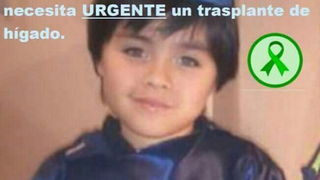 Niño que espera donante recibirá parte del hígado de su padre