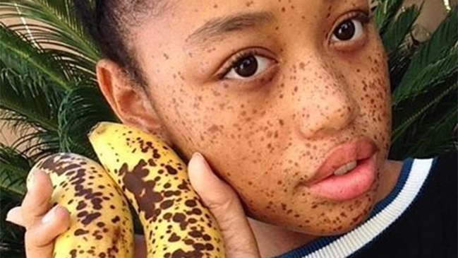 La extraordinaria revancha de la niña con 