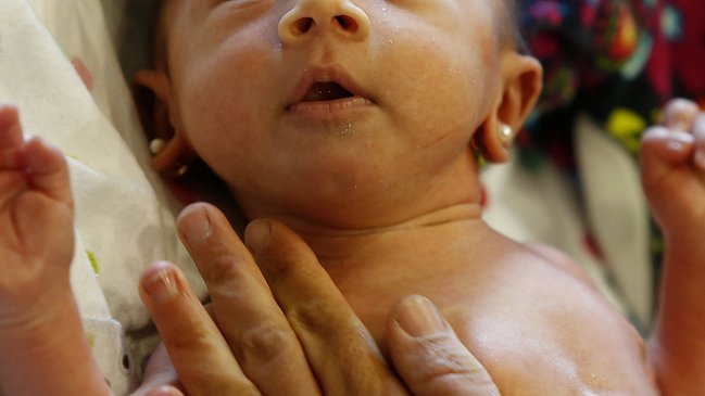 Mañalich y obstetras desmienten a Fonasa: No hay examen de estreptococo B en el sistema público