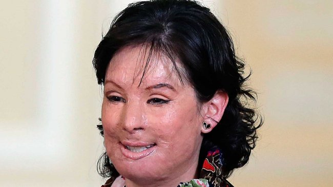 Veinte años de cárcel para hombre que atacó con ácido a una joven con quien se obsesionó