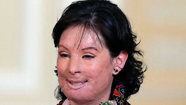 Veinte años de cárcel para hombre que atacó con ácido a una joven con quien se obsesionó