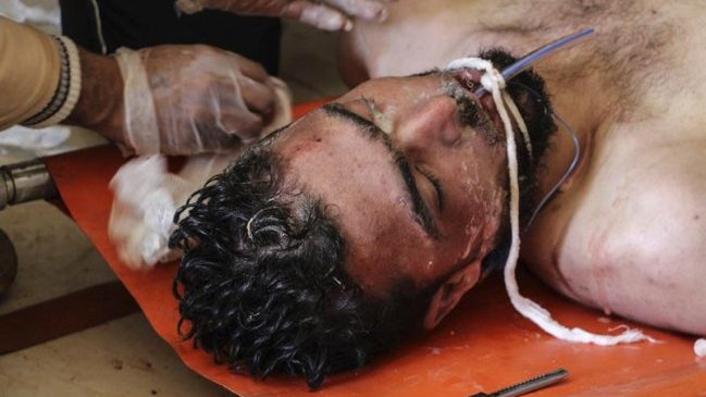 Casa Blanca afirmó que ni siquiera Hitler usó armas químicas como Al-Asad