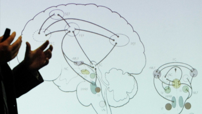 Cuba anunció ensayo clínico con medicamento para retrasar avance de alzheimer