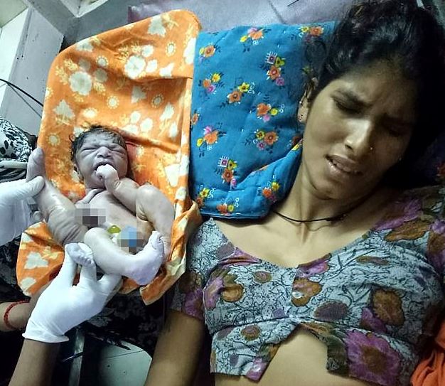 Niño Nació Con Cuatro Piernas Y Tres Manos En India Cooperativacl 3172