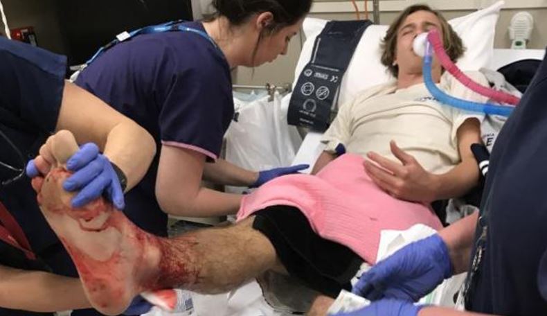 Desconocidas criaturas marinas atacaron a un joven en Australia