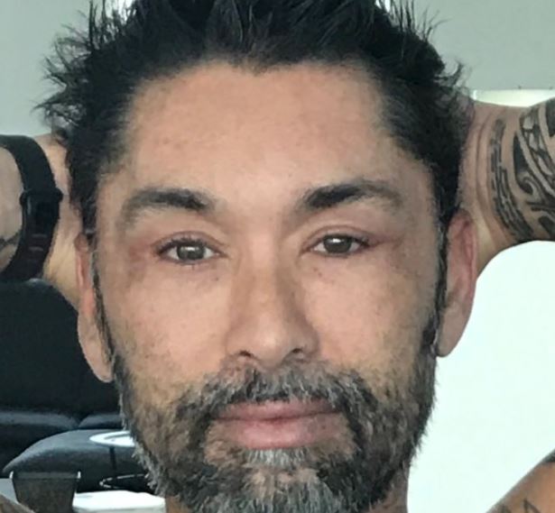 Cirujano plástico explicó detalladamente las operaciones que se realizó Marcelo Ríos